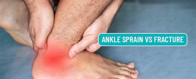 Ankle Sprain vs Fracture: Key Differences, Symptoms & Best Treatment