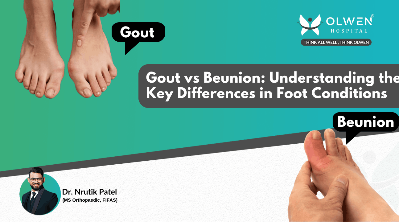 Gout vs Beunion Understanding the Key Differences in Foot Conditions (1)