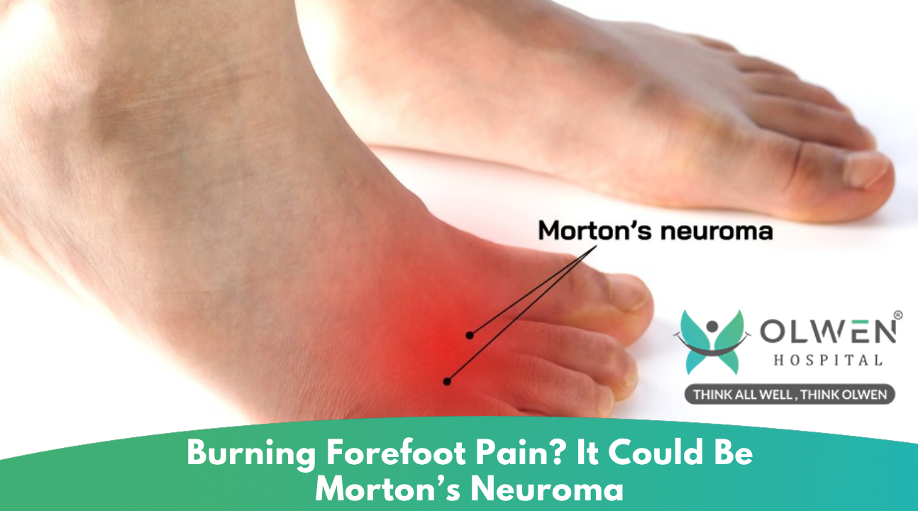 Burning Forefoot Pain It Could Be Morton’s Neuroma
